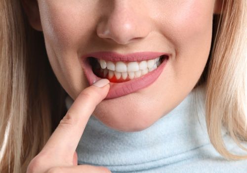 Dấu hiệu nhận biết viêm nha chu? Cách điều trị viêm nha chu tại nhà