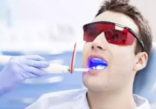 Điều trị viêm nha chu bằng laser có thực sự tốt?