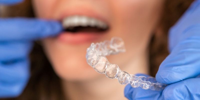 quy-trinh-nieng-rang-invisalign-5